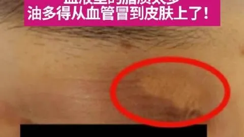 电竞战队商业价值提升，赞助商竞相追捧